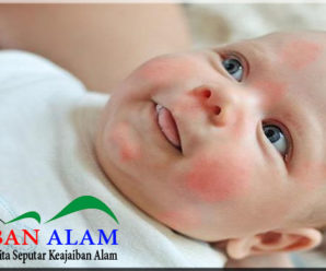Penyebab Munculnya Alergi pada Anak Usia Dini